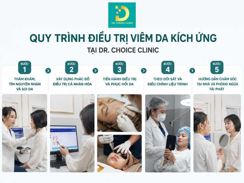Phòng Khám Điều Trị Viêm Da Kích Ứng An Toàn, Hiệu Quả HCM 14 Quy trình điều trị viêm da kích ứng tại Dr. Choice Clinic diễn ra như thế nào?