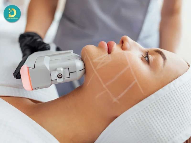 Phòng Khám Nâng Cơ & Xóa Chảy Xệ Uy Tín Hiệu Quả TpHCM 19 Thực hiện liệu trình chuẩn y khoa