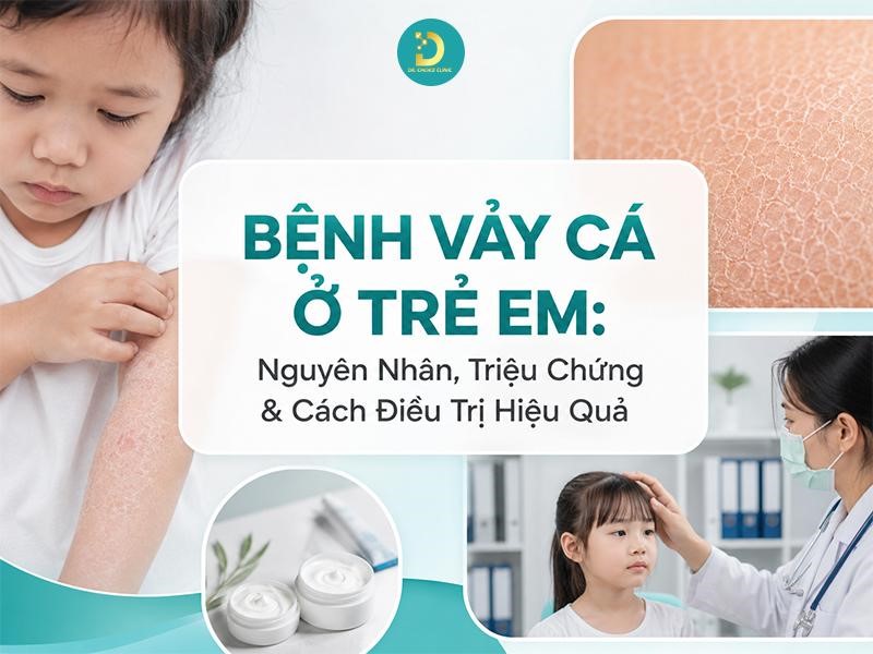 Bệnh Vảy Cá Ở Trẻ Em: Nguyên Nhân, Triệu Chứng & Cách Điều Trị Hiệu Quả 10 Tìm hiểu bệnh vảy cá ở trẻ em