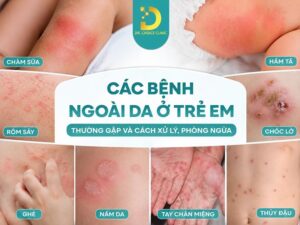 Các bệnh ngoài da ở trẻ em