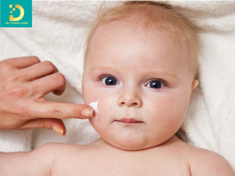 Viêm Da Tiếp Xúc Ở Trẻ Em: Nguyên Nhân, Biểu Hiện & Cách Điều Trị Hiệu Quả 12 Điều trị viêm da tiếp xúc ở trẻ em