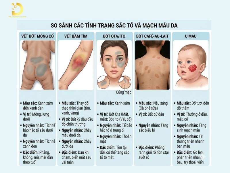 Vết Bớt Mông Cổ Ở Trẻ Sơ Sinh Có Tự Hết Không? 10 Phân biệt vết bớt mông cổ và các bệnh lý về da khác