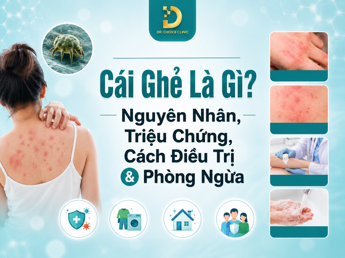 Cái Ghẻ Là Gì? Nguyên Nhân, Triệu Chứng, Cách Điều Trị & Phòng Ngừa 7 Tìm hiểu về bệnh ghẻ