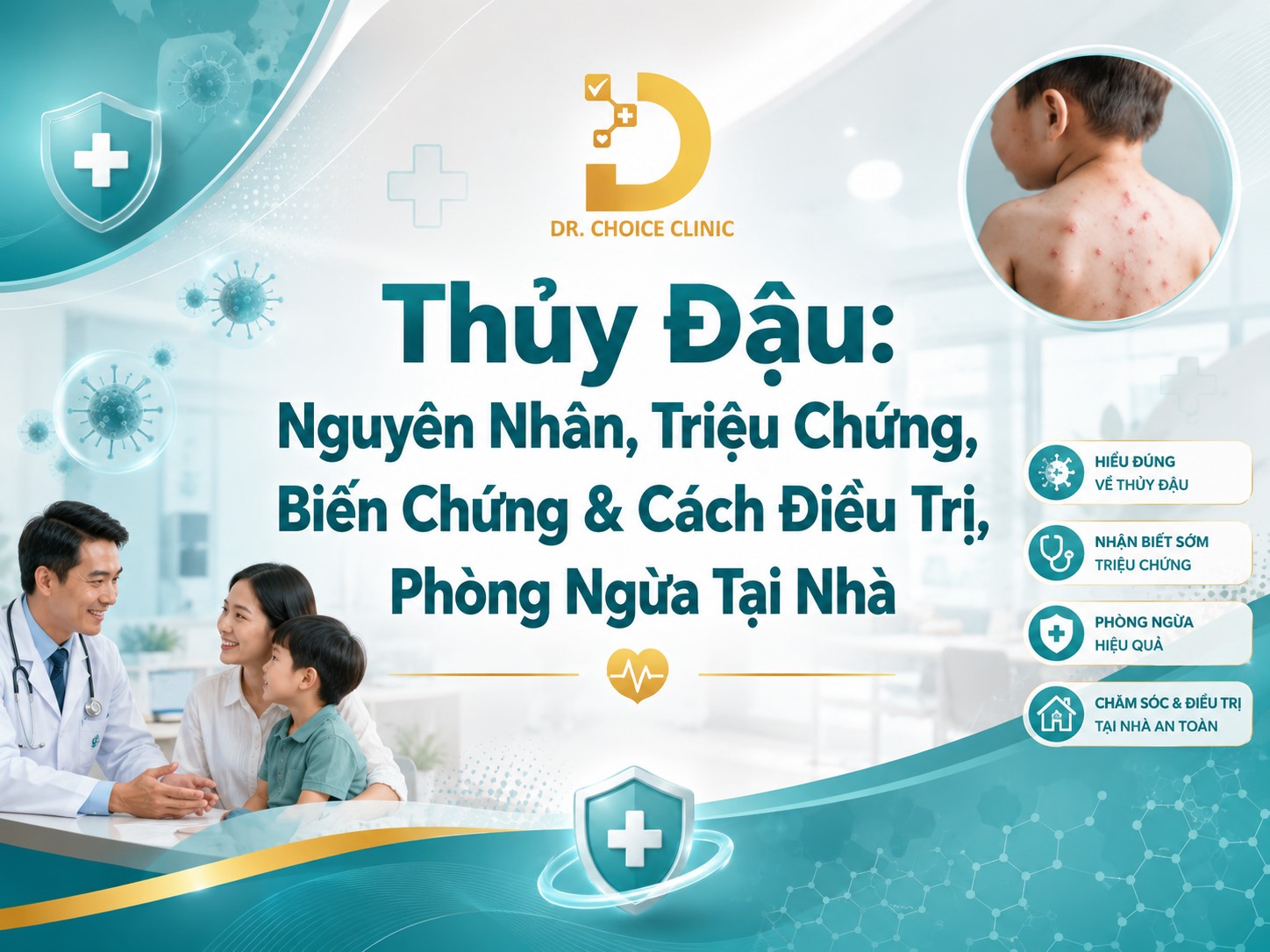 Thủy Đậu: Nguyên Nhân, Triệu Chứng, Biến Chứng & Cách Điều Trị, Phòng Ngừa Tại Nhà 8 Tìm hiểu về bệnh thủy đậu