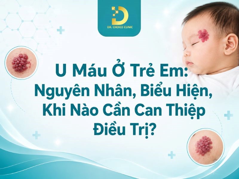 U Máu Ở Trẻ Em: Nguyên Nhân, Biểu Hiện, Khi Nào Cần Can Thiệp Điều Trị? 9 Tìm hiểu bệnh u máu ở trẻ em