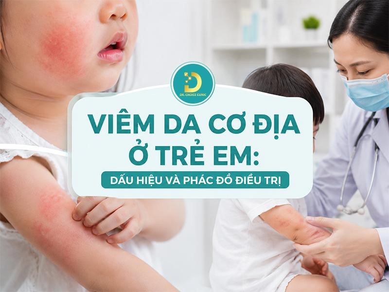 Viêm Da Cơ Địa Ở Trẻ Em: Dấu Hiệu Và Phác Đồ Điều Trị 8 Viêm da cơ địa trẻ em