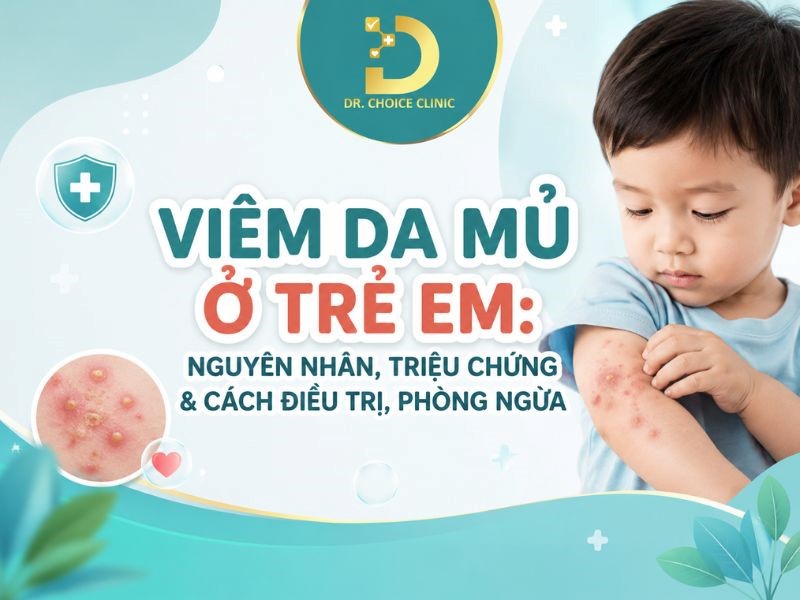 Viêm Da Mủ Ở Trẻ Em: Nguyên Nhân, Triệu Chứng & Cách Điều Trị, Phòng Ngừa 7 Tìm hiểu về viêm da mủ ở trẻ em