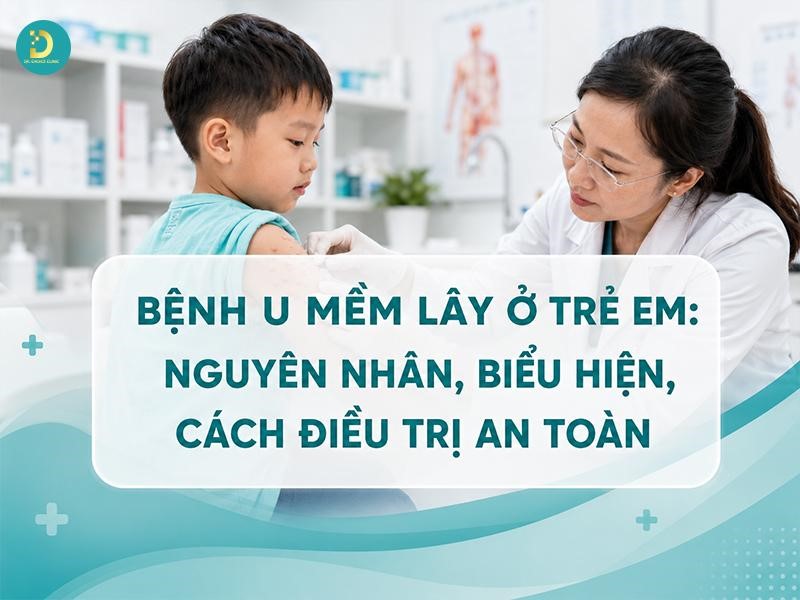 Bệnh U Mềm Lây Ở Trẻ Em: Nguyên Nhân, Biểu Hiện, Cách Điều Trị An Toàn 10 Tìm hiểu bệnh u mềm lây ở trẻ em