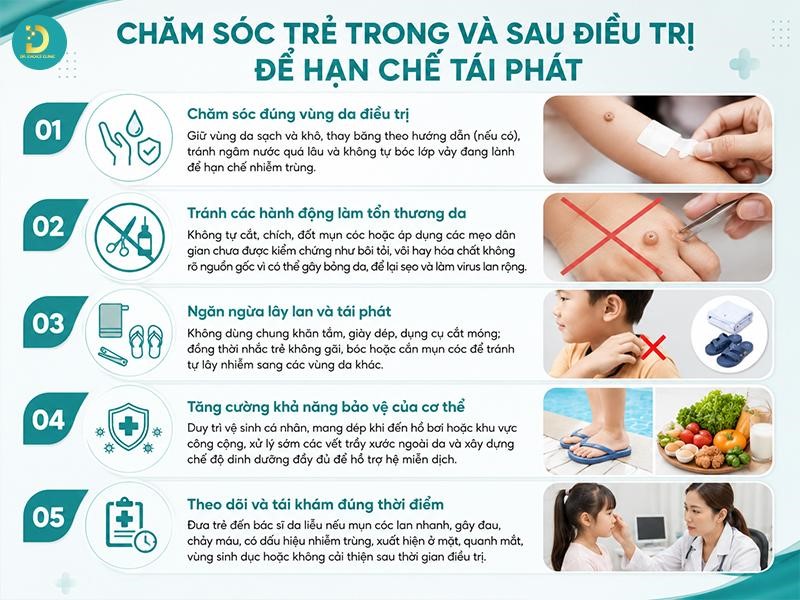 Mụn Cóc Ở Trẻ Em: Nguyên Nhân, Biểu Hiện & Cách Điều Trị An Toàn 17 Chăm sóc trong và sau điều trị hạn chế tái phát mụn cóc