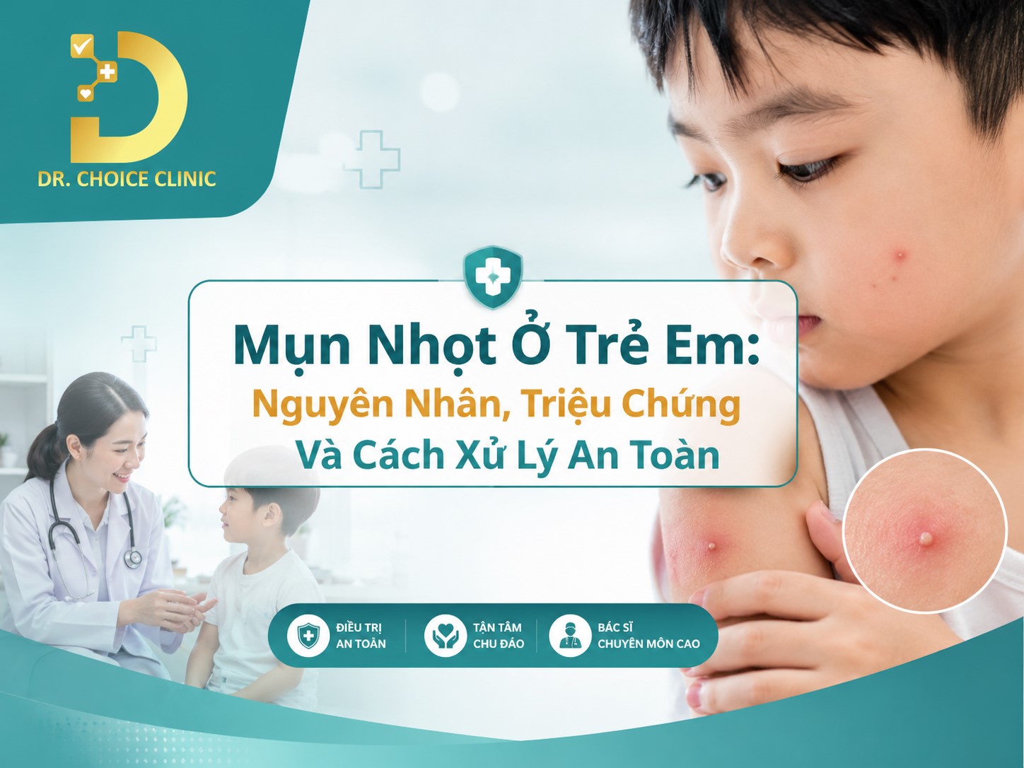 Mụn Nhọt Ở Trẻ Em: Nguyên Nhân, Triệu Chứng Và Cách Xử Lý An Toàn 7 Tìm hiểu về bệnh mụn nhọt ở trẻ em