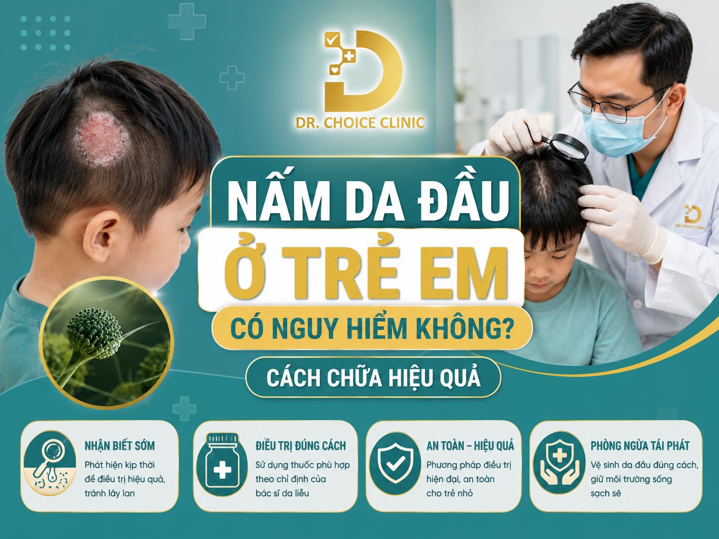 Nấm Da Đầu Ở Trẻ Em Có Nguy Hiểm Không? Cách Chữa Hiệu Quả 7 Tìm hiểu về bệnh nấm da đầu ở trẻ em