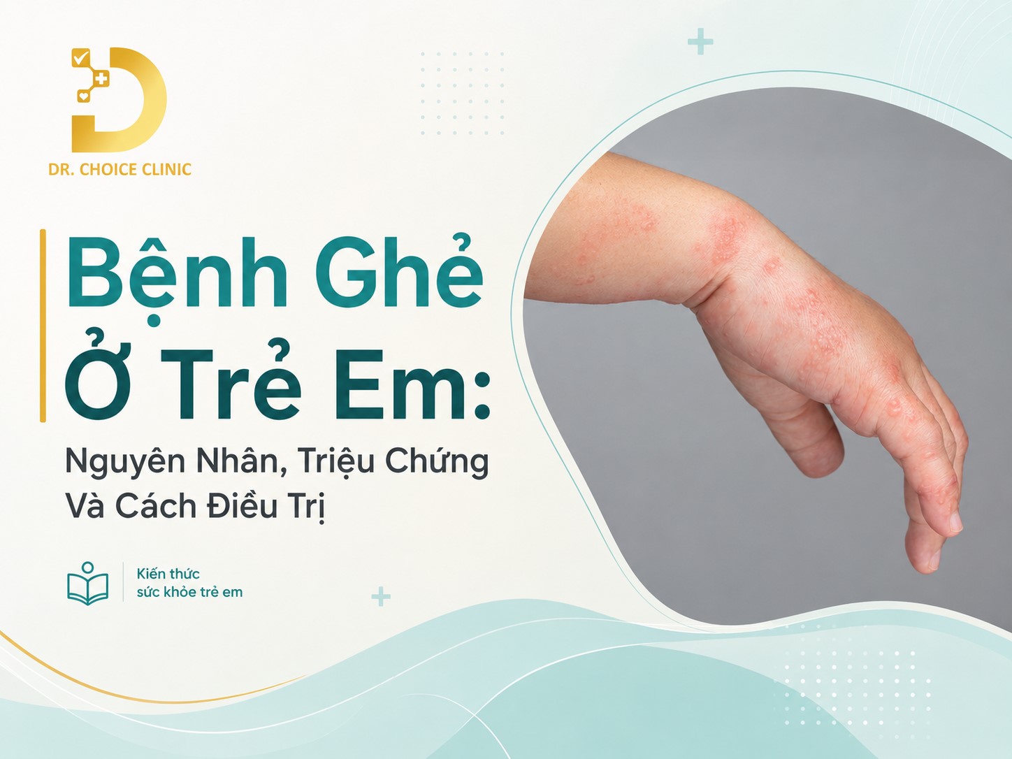 Bệnh Ghẻ Ở Trẻ Em: Nguyên Nhân, Triệu Chứng Và Cách Điều Trị 7 Tìm hiểu về bệnh ghẻ ở trẻ em