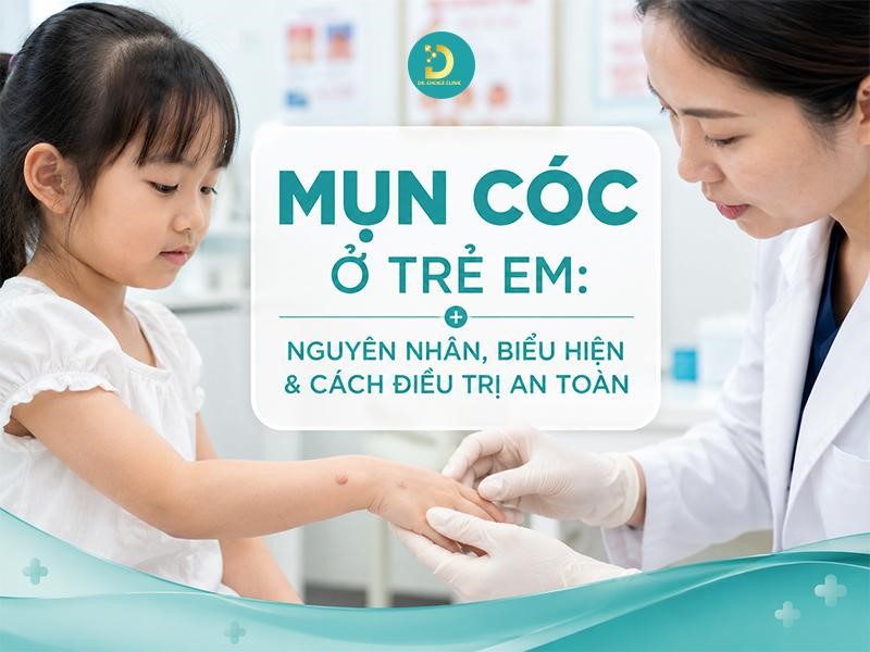 Mụn Cóc Ở Trẻ Em: Nguyên Nhân, Biểu Hiện & Cách Điều Trị An Toàn 10 Tìm hiểu về mụn cóc ở trẻ em