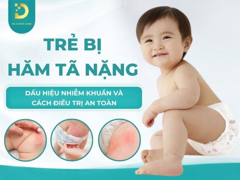 Trẻ Bị Hăm Tã Nặng: Dấu Hiệu Nhiễm Khuẩn Và Cách Điều Trị An Toàn 12 Tìm hiểu trình trạng trẻ bị hăm tả nặng