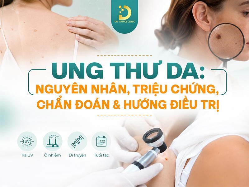 Ung Thư Da: Nguyên Nhân, Triệu Chứng, Chẩn Đoán & Hướng Điều Trị 10 Tìm hiểu về ung thư da