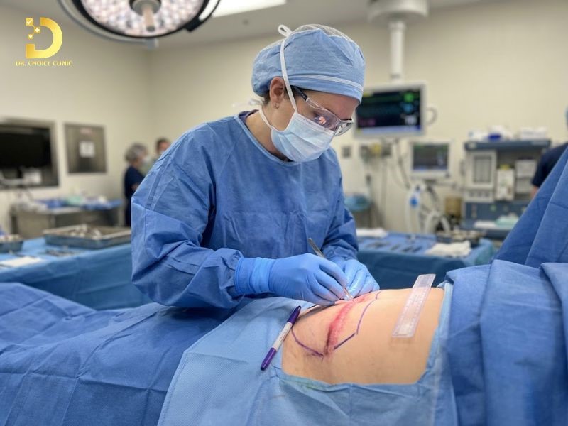 Vết Sẹo Mổ Đẻ Bị Lồi: Nguyên Nhân & Cách Điều Trị Hiệu Quả 11 Điều trị sẹo lồi mổ đẻ (ảnh minh họa)