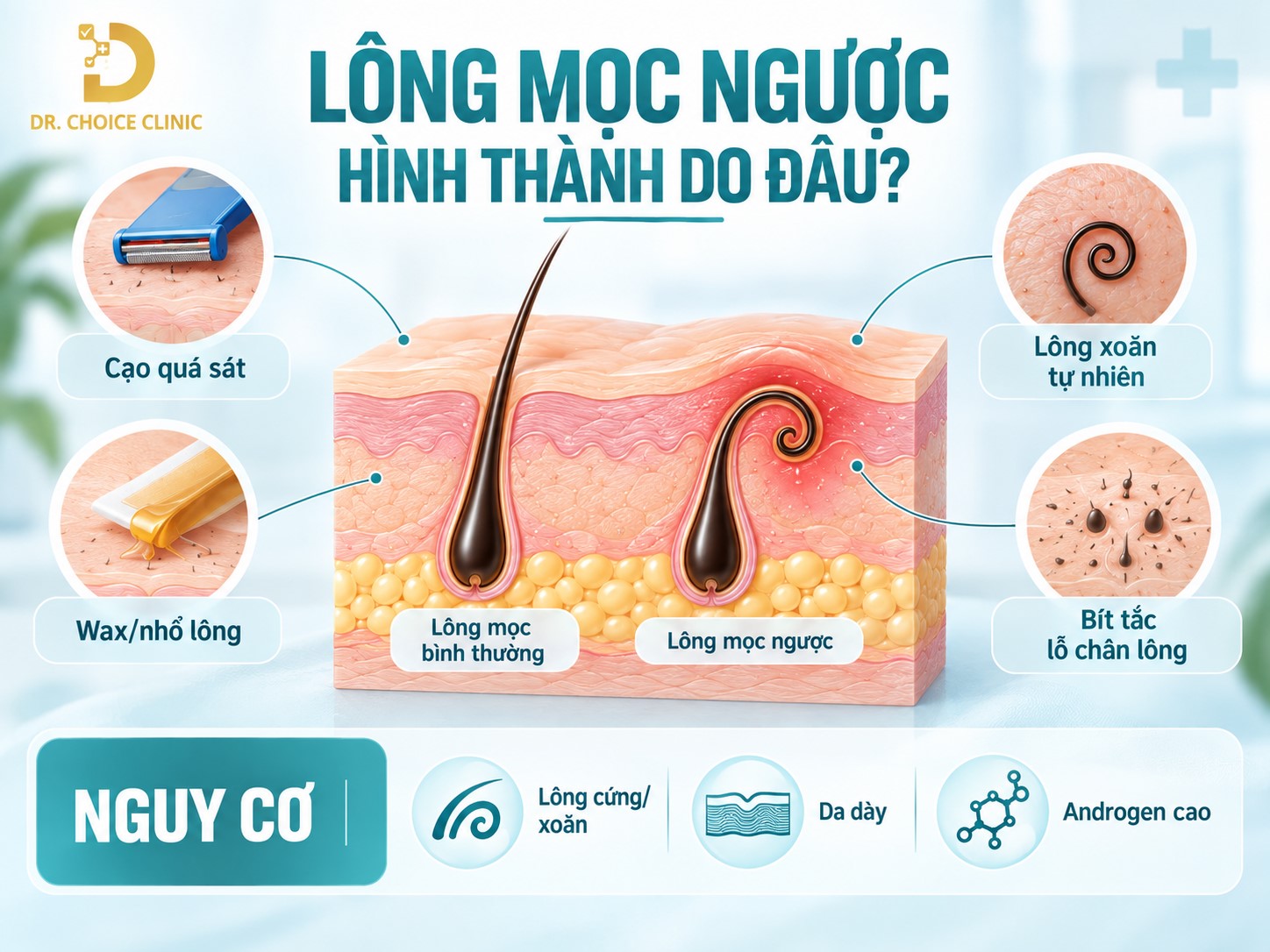 Lông Mọc Ngược Là Gì? Nguyên Nhân Và Cách Xử Lý Hiệu Quả 11 Cơ chế, nguyên nhân gây ra tình trạng lông mọc ngược