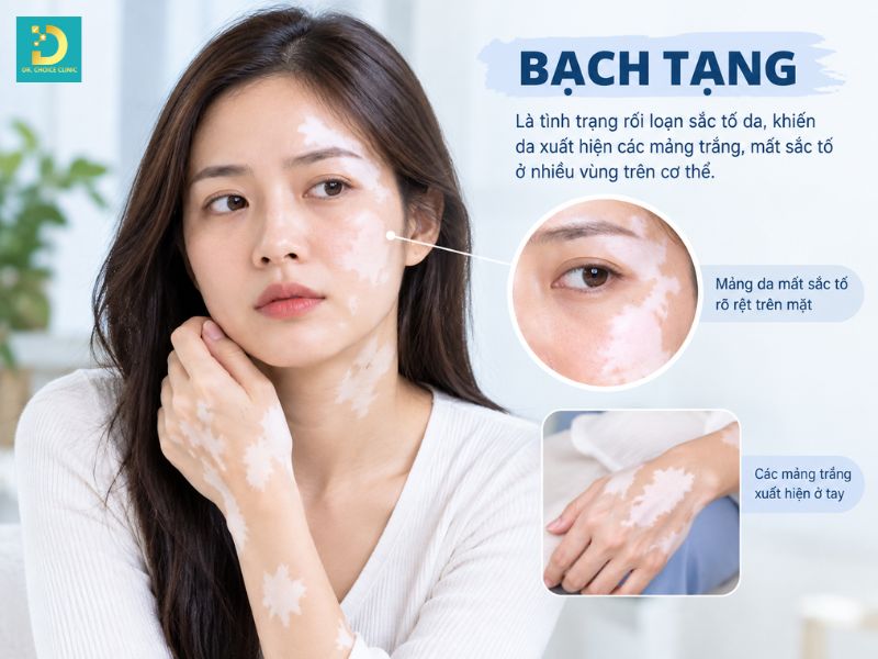 Sắc Tố Melanin: Các Loại, Cơ Chế Hình Thành, Vai Trò & Các Vấn Đề Liên Quan 15 Bạch tạng là vấn đề phổ biến của giảm sắc tố Melanin