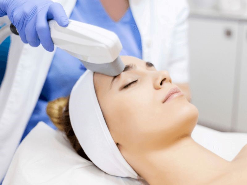 Review Top 5 Công Nghệ Trị Nám Phổ Biến Nhất Hiện Nay 11 Trị nám bằng công nghệ ánh sáng IPL (ảnh minh họa)