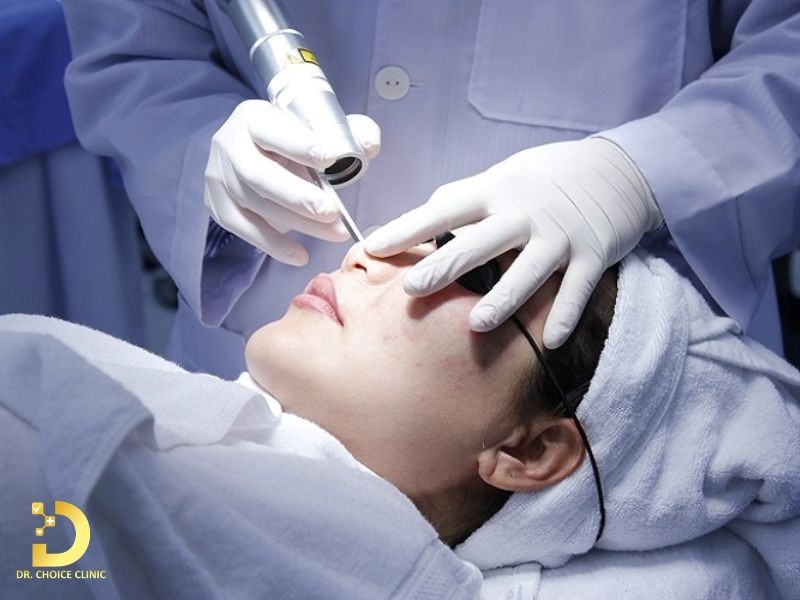 Review Top 5 Công Nghệ Trị Nám Phổ Biến Nhất Hiện Nay 10 Trị nám bằng công nghệ Laser Toning (ảnh minh họa)