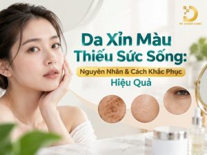 Da xỉn màu thiếu sức sống