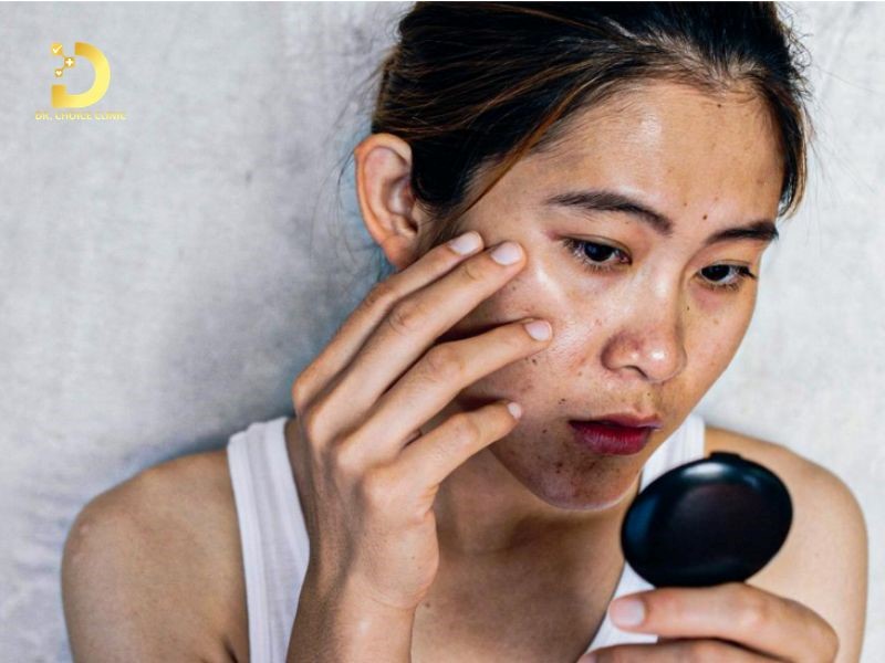 Da Xỉn Màu Thiếu Sức Sống: Nguyên Nhân & Cách Khắc Phục Hiệu Quả 9 Da xỉn màu thiếu sức sống (ảnh minh họa)
