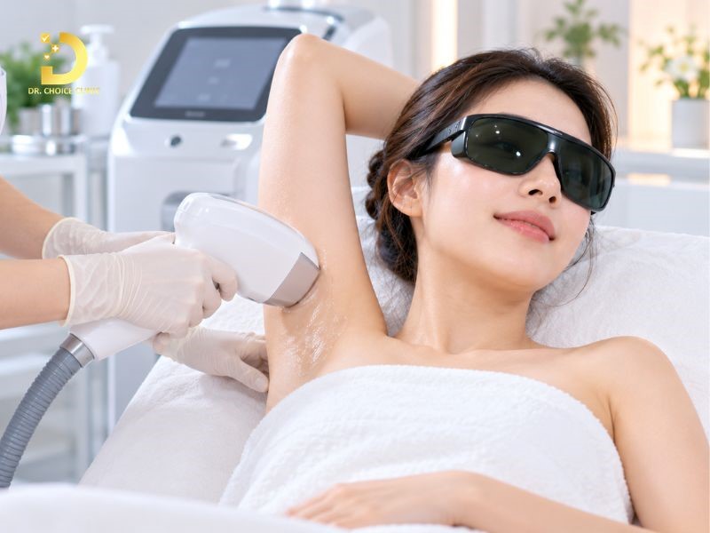 Triệt Lông Là Gì? Lợi Ích, Phương Pháp & Lưu Ý Quan Trọng 11 Triệt lông (ảnh minh họa)