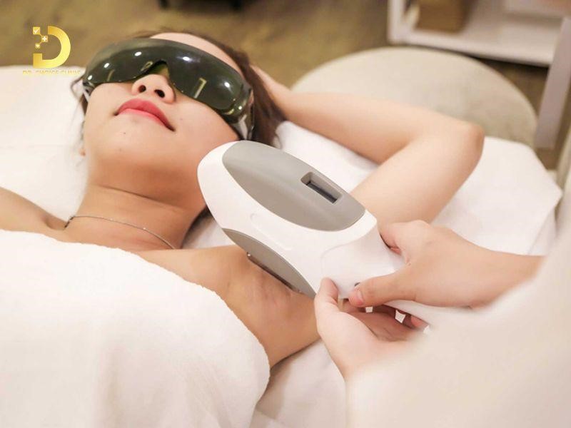Triệt Lông Là Gì? Lợi Ích, Phương Pháp & Lưu Ý Quan Trọng 16 Triệt lông bằng Laser